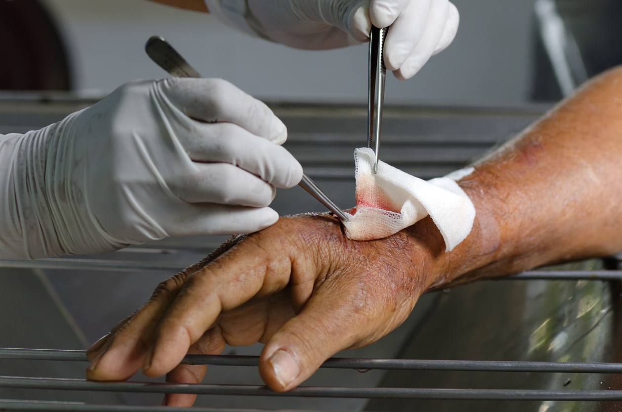 Wound Care and Infection Prevention<