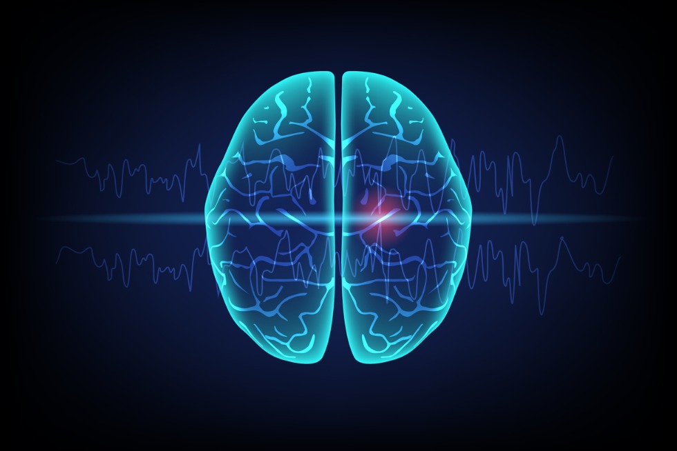 Introduction to Seizures<